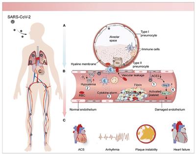 The cross-talk of lung and heart complications in COVID-19: Endothelial cells dysfunction, thrombosis, and treatment